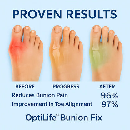 Bunion Corrector